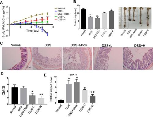 Figure 3 The effects of SRP-NPs on an acute mouse model of IBD. (A) 40 mice were randomly divided into five groups with eight mice in each group: Normal, DSS, DSS + Mock (3 mg/20 g MP-NPs), DSS + L (1 mg/20 g SRP-NPs), and DSS + H group (3 mg/20 g SRP-NPs). After 3 days of continuous administration as described above, 2.5% DSS was administered. Weight loss was measured daily and expressed as the average percentage of initial body weight ± SEM. (B) The length of colons from mice was measured on day 7 after euthanasia. (C) Representative histological images of mice on the 7th day were compared. (D) Colon mucosa damage index (CMDI) scoring was assessed in a blinded fashion. (E) The mRNA expression of colon mucosa SNX10 was measured by qRT-PCR. *P<0.05, **P < 0.01, ***P < 0.001 vs DSS+Mock group; #P < 0.05, ##P < 0.01vs Normal group; n = 8 in each group.