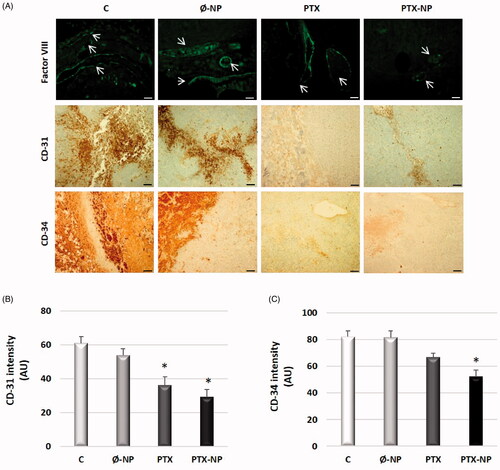 Figure 7. PTX-NP inhibits angiogenesis in the HNSCC tumor model. (A) Measurement of IF and IHC stained Factor VII (top panel), CD31 (central panel), and CD34 (bottom panel) expression in tumors. Scale bar, 100 μm. Representative images were randomly taken blindly. Experimental groups: C (control); Ø-NP (unloaded NPs, 1 mg/ml; PTX (Paclitaxel, 5 mg/kg); and PTX-NP (Paclitaxel loaded NPs, 5 mg/kg for 21 days. (B and C) Quantification of immunostaining for CD-31 (B) and CD-34 (C) using the ImageJ software. Data represent the mean ± SD of arbitrary units (AU). *p < .05 versus C and Ø-NP groups; (n = 20).