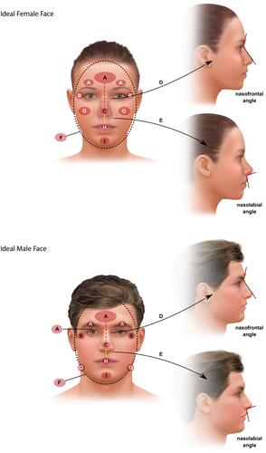 Figure 1 Schematic of facial aesthetic goals for transitioning individuals. Based on Table 1, the ideal female face has the following features: (A) Large, smooth forehead with some convexity and arched eyebrows, (B) Eyes that appear wide open, (C) Proportionally smaller, narrow nose with upturned nasal tip, (D) Obtuse nasofrontal angle, (E) Obtuse nasolabial angle, (F) Heart-shaped taper in lower face with smaller lower-to-upper face ratio, (G) Prominent, full cheeks and cheekbones, (H) Full lips, especially anteroposterior axis, and (I) Rounded, narrow, proportionally short chin. The ideal male face has the following features: (A) Wider forehead with horizontal brow and prominent supraorbital ridge, (B) Deeper-set eyes that appear close together, (C) Proportionally larger, wider, more projected nose, (D) Less obtuse nasofrontal angle, (E) Less obtuse nasolabial angle, (F) More equal ratio of lower-to-upper face proportions, (G) Squared lower face and jaw, (H) Wider mouth with thinner lips, and (I) Long, square, flat chin.