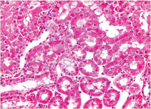 Figure 5. Kidney of Cisplatin group the proximal tubule showed apoptotic body near the luminal border of the epithelium with few prominent nucleoli.