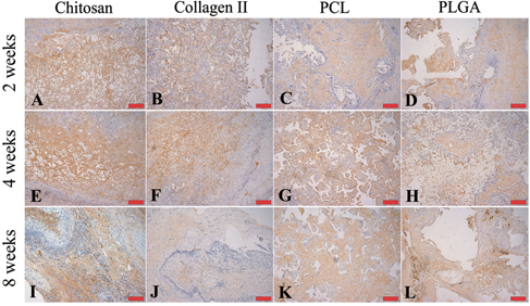 Figure 7. Representative images of chitosan (A), (E), (I), collagen type II (B), (F), (J), PCL (C), (G), (K) and PLGA (D), (H), (L) stained for collagen type II (brown color) after harvest from an in vivo bioreactor at 2 (A)–(D), 4 (E)–(H) and 8 (I)–(L) weeks. Scale bars = 100 μm.