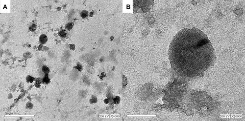 Figure 5 Transmission electron micrographs of the optimized ivabradine nanovesicles (A) X4000, (B) X 20000.