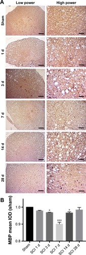 Figure 4 Immunohistochemistry of MBP in the SCI and sham operation groups.