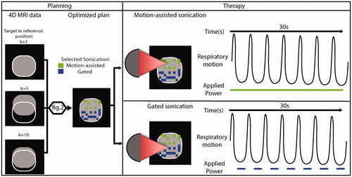 Figure 1. Illustration of combined motion-assisted/gated HIFU treatment. Motion-assisted/gated HIFU treatment follows the same steps as conventional MRHIFU with a planning and therapy delivery phase. As part of the planning, a 4D-MRI set to characterize the target motion is acquired and is then used to generate an optimized plan that takes into account this target motion. More details on this optimization are provided in Figure 2. In the treatment phase, the system delivers motion-assisted sonications by applying power throughout the respiratory cycle, or gated sonications by limiting energy delivery to end expiration.