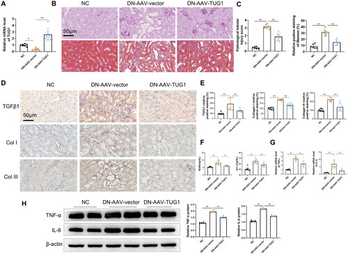 Figure 2. Delivery of AAV-TUG1 ameliorates kidney injuries in DN mice. (A) TUG1 expression increased significantly in kidney tissues in mice by AAV-mediated gene delivery; (B–C) AAV-TUG1 overexpression significantly attenuates the pathological injuries (HE staining analysis) and fibrosis (Masson’s trichrome) in DN mice. (D–E) AAV-TUG1 overexpression significantly attenuates the renal TGF-β1, collagen I and III protein level in DN mice by immunohistochemistry. (F) AAV-TUG1 overexpression significantly improves kidney function by decreasing BUN and Scr concentration; (G) AAV-TUG1 overexpression attenuates mRNA levels of TNFα and IL-6 in DN mice; (H) AAV-TUG1 overexpression attenuates protein levels of TNFα and IL-6 in DN mice.