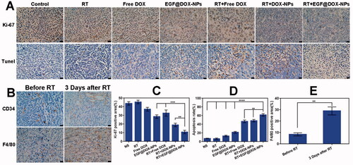 Figure 8. Immunohistochemical analysis. (A) Images of Ki-67 staining and the TUNEL staining. (B) Images of CD34 and F4/80 expression. (C and D) Quantitative analysis of Ki-67 and TUNEL positive areas in different groups. (E) Quantification of F4/80 labeled TAMs in tumor tissues before and after radiotherapy. (Mean ± SD; n = 3; Scale bar: 20 µm). ** p < .01, *** p < .001, **** p < .0001.
