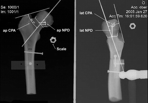 Figure 5. Post-operative X-rays used to assess pin placement relative to initial surgical goals.