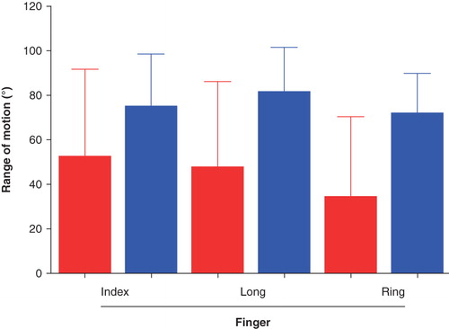 Figure 5. Mean (SD) passive range of motion of the PIP joints preoperatively compared with 6 months postoperatively in the severe group. There were significant increases in range of motion postoperatively in the long and ring finger. Red = before, and blue = after, operation.