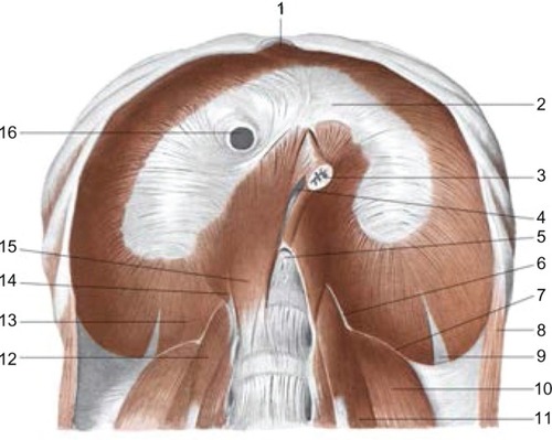 Figure 2 The sub-diaphragmatic area: 2: tendinous center or phrenic; 16: inferior vena cava; 3: esophagus; 5: aortic orifice; 15: medial pillar; 14: intermediate pillar; 13: pillar lateral; 6: pillar arcuate medial; 7: lateral arcuate ligament; 10: quadratus lumborum muscle; 11: psoas major muscle.AA VV, Anatomia dell’uomo, 4 ed, Edi.ermes [Several authors, Human Anatomy, Fourth Edition, edition EdiErmes], Milano. www.eenet.it