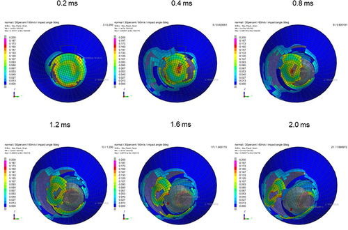 Figure 20 Sequential strain strength response of ocular surface of model eye upon airbag impact in straight position at 60 m/s with adhesion strength of scleral flap of 30%, shown at 0.4-ms intervals after 0.2 ms. Strain strength change is displayed in color as presented in the color bar scale (Figure 2).