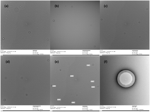 Figure 3. TEM micrographs of optimum niosomal formula (F1).