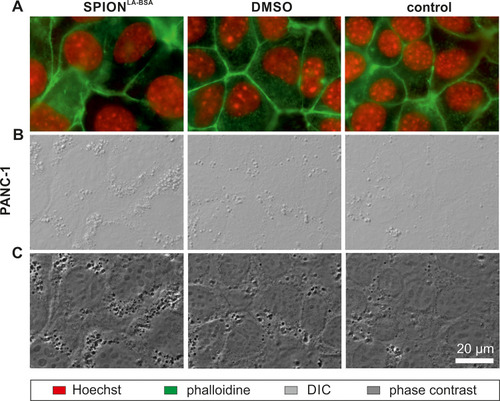 Figure 5 SPION load visualized by optical imaging. PANC-1 cells were treated with unlabeled SPIONLA-BSA (100 µgFe/mL) or with the corresponding amount of H2O or DMSO (final concentration of 2%) for 24 h and visualized by (A) fluorescent staining for nuclei (Hoechst 33342, red) and actin cytoskeleton (Alexa Fluor 488 Phalloidin, green), (B) differential interference contrast (DIC) and (C) phase contrast. Compared to few spots with high contrast within control and DMSO samples, numerous areas of high contrast indicate SPION accumulations within vesicles in nanoparticle-treated cells.