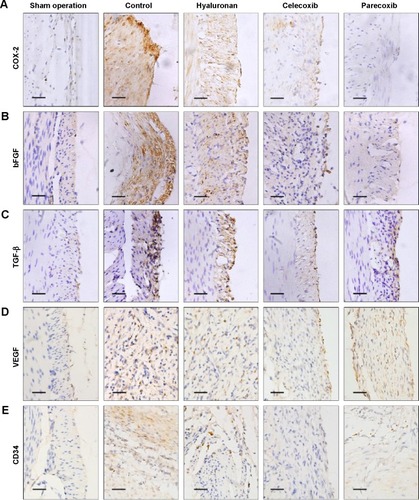 Figure 6 Immunohistochemical analysis of cyclooxygenase (COX)-2 (A), basic fibroblast growth factor (bFGF) (B), transforming growth factor-beta (TGF-β) (C), vascular endothelial growth factor (VEGF) (D), and cluster of differentiation (CD) 34 (E) in intra-abdominal adhesion tissues from groups that underwent peritoneum and cecum abrasion, and normal peritoneum in the sham operation group.