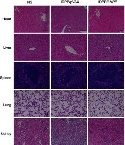 Figure 5 Histological analysis of H&E-stained vital organ sections. The heart, liver, spleen, lung, and kidney in NS, iDPP/pVAX and iDPP/LHPP groups were collected and conducted with H&E staining, respectively. No significant pathological changes were detected.