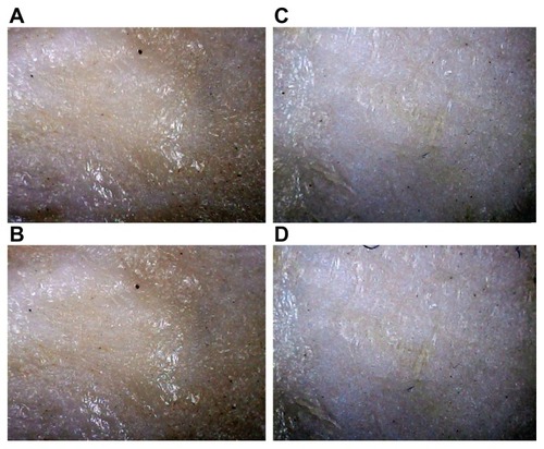 Figure 8 Pictures of the skin surface before and after each extraction experiment. All pictures were captured by a microscope with a magnification of 60×. (A and B) Before and after the extraction experiment, respectively, with application of electroporation (74 V/cm) and reverse iontophoresis (phase duration = 180 seconds). (C and D) Before and after extraction experiment, respectively, with application of electroporation (592 V/cm) and reverse iontophoresis (phase duration = 180 seconds).