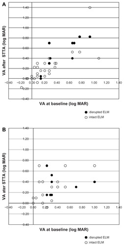 Figure 1 (A) Relationship between visual acuity (log MAR) at baseline and after sub- Tenon injection of triamcinolone acetonide (STTA) for cystoid macular edema (CME) in eyes without serous retinal detachment (SRD). Solid circles indicate the visual acuity (VA) of eyes with disruption of the external limiting membrane (ELM), and open circles indicate the VA of eyes with an intact ELM. The eyes with an intact ELM had better VA both at baseline and after STTA. (B) Relationship between visual acuity (log MAR) at baseline and after STTA in eyes with SRD (with or without CME).