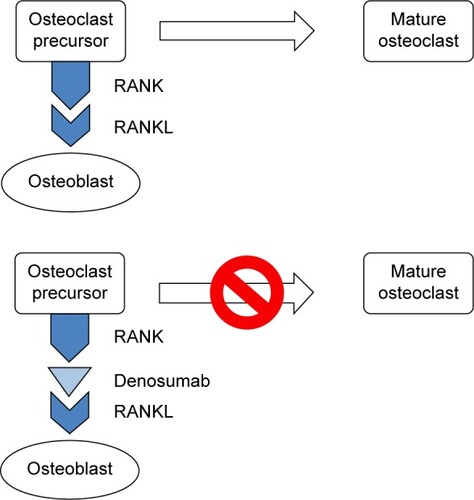 Figure 1 Osteoclast maturation activation and denosumab inhibition of osteoclast maturation.