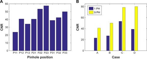 Figure 9 CNR of reconstructed images in (A) Figure 8 and (B) Figure 10.Abbreviation: CNR, contrast-to-noise ratio.