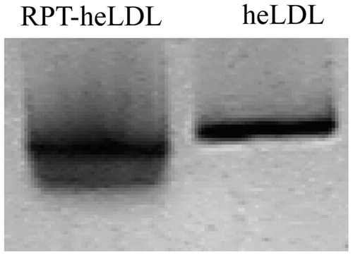 Figure 3. About 0.6% agarose gel electrophoresis analyses of heLDL and RPT–heLDL.