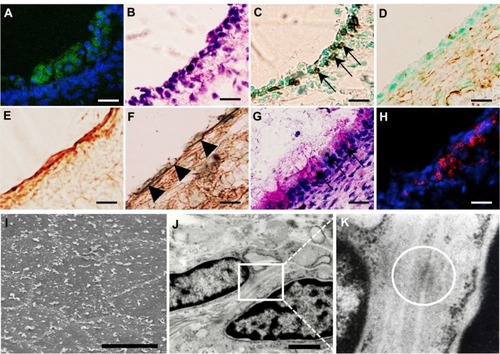 Figure 5 (A–K) Analysis of transplanted mucosal epithelial cells in the recipient tissues at postoperative day 7. (A–H) Serial frozen sections of middle-ear bullae after transplantation at a concentration of 0.5 × 106 cells/mL Enhanced green fluorescent protein-expressing cells were found on the internal surface of the recipient middle-ear bullae under laser scanning microscope (green, enhanced green fluorescent protein; blue, 4′,6-diamidino-2-phenylindole) (A) and were localized on the surface of the subepithelial layer and compared with hematoxylin and eosin staining (B). These cells were positive for pancytokeratin (C, arrows) but not for vimentin (D). Collagen III-positive cells were detected mainly in the subepithelial layer (E) while collagen IV-positive cells were detected under the donor cells, resembling basement membrane (F) (arrowheads). Some epithelial cells were positive for periodic acid–Schiff staining (G, arrows). E-cadherin-positive cells were detected between adjacent epithelial cells (red, E-cadherin) (H). Scale bars, 20 μm. (I–K) Ultrastructural analysis. Scanning electron microscopy confirmed the morphology of the regenerating epithelial surface, which consisted of flat polygonal squamous cells (I), scale bar 50 μm. Transmission electron microscopy identified the formation of adhesion-junction-like structures between adjacent epithelial cells (J and K, white circle), scale bar 1 μm.