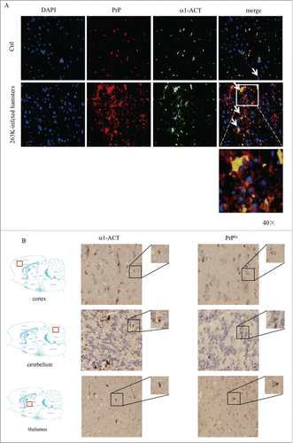 FIGURE 4. Analyses of the association of α1-ACT with PrP in brain tissues. a Representative images of double-stained IFA assays with the antibodies of α1-ACT (green) and PrP (red) on the brain sections of normal and 263K-infected hamsters (100 ×). The zoomed-in pictures are shown on the bottom. b Representative images of IHC assays for α1-ACT and PrPSc in the serial sections of different brain regions of 263K-infected hamsters, including cortex, thalamus and cerebellum (indicated above). The magnified images are shown on the top right of each picture and the positions of the observing fields within the whole brain are indicated on the left.