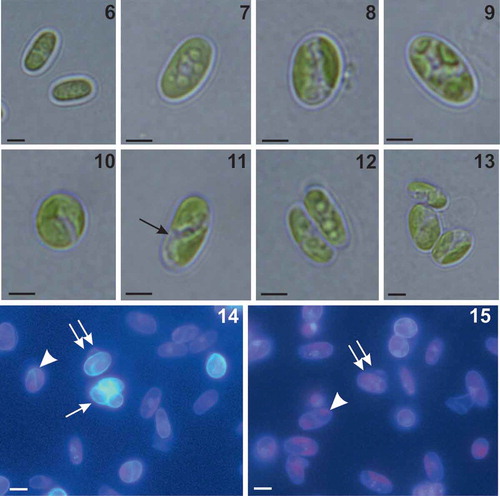 Figs 6–15. Morphology of Coccomyxa cimbrica sp. nov. Figs 6–10. Variable shapes of culture cells. Fig. 11. Cell reproduction by oblique division (arrow). Figs 12–13. Asexual reproduction through cell division with the formation of 2–4 autospores. Figs 14–15. Fluorescence images of culture cells stained with 4′,6 diamidino-2-phenylindole (DAPI). Note small mucilaginous caps (double arrows), reproduction by oblique division (arrow head) and, in Fig. 14, an autosporangium (arrow). Scale bars: Figs 6–13, 2 µm; Figs 14–15, 3 µm.