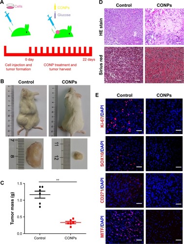 Figure 4 CONPs depressed the growth of melanoma effectively in vivo.Notes: (A) Scheme of melanoma therapy in vivo with CONPs. All the tumors in CONPs group were treated with CONPs (16 mg/kg), while control group tumors were treated with 5% glucose. Intratumoral injection was performed every 2 days and the total volume of injection for each tumor was 0.2 mL every time. The time span for the treatment was 22 days. (B) Representative images of stripped subcutaneous tumors. The diameters of subcutaneous tumors in the CONPs group were obviously smaller than the diameters in the glucose group. (C) Tumor mass comparison between CONPs and control group. The tumor mass of CONPs group was lower than that of control group after treatment for 22 days. Six mice per group. (D) Representative images of structural damage by H&E stain and fibrosis by Sirius red stain in CONPs group tumors. Scale bars represent 100 μm. (E) Representative immunity fluorescence images of paraffin section for tumors of control and CONPs group. Ki-67, SOX10, CD271 and MITF were stained with red fluorescence and showed the dramatic declination of expression. And the paraffin sections were fixed and stained with DAPI. Scale bars represent 100 μm. The error bars represent ± standard deviation (**P<0.01).Abbreviations: CONPs, cuprous oxide nanoparticles; DAPI, 4′,6-diamidino-2-phenylindole; H&E, hematoxylin and eosin.