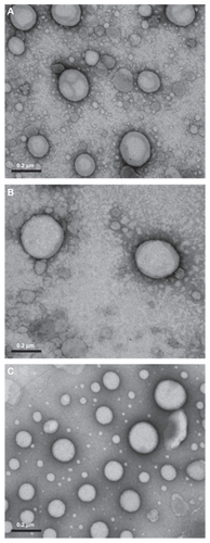Figure 1 Transmission electron micrographs of the complexes formed between nanoemulsions/DNA phosphatidylcholine (A), phosphatidylcholine/stearylamine (B), and 1,2-distearoyl-sn-glycero-3-phosphocholine/stearylamine (C) in the charge ratio of 2.0. 100,000× magnification.