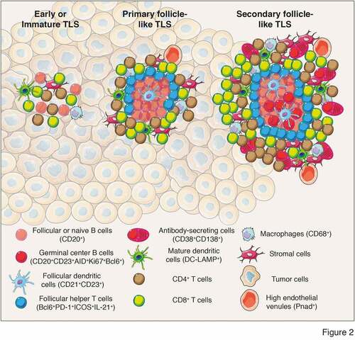 Figure 2. Different levels of TLS maturation and their composition. Tumor-associated TLS are heterogenous and range from poorly-organized cellular aggregates (Early or immature TLS) to well-organized structures forming primary follicles or secondary follicles containing germinal centers surrounded by specific vessels called high endothelial venules (PNad+). Their cellular composition include stromal cells, innate and adaptive immune cells. In most of the analyses performed, cellular composition has been determined using immunofluorescence or immunochemistry analyses and relies on the expression of cell-specific markers to identify the cell types that form TLS. Mature secondary follicle-like TLS harbor a germinal center composed of proliferating mature germinal center B lymphocytes (CD20+CD23+AID+Ki67+Bcl6+) and follicular dendritic cells (CD21+CD23+) surrounded by naïve or follicular B cells (CD20+) and bordered by follicular helper T cells (Bcl6+PD-1+ICOS+IL-21+). In addition, TLS are formed of CD4+ and CD8+ T cells (CD3+), plasma cells (CD38+CD138+), mature dendritic cells (DC-LAMP+) and macrophages (CD68+). CD, cluster of differenciation; DC-LAMP, dendritic cell lysosomal associated membrane glycoprotein; PD-1, programmed cell death 1; ICOS, Inducible costimulator; AID, activation-induced deaminase; Bcl6, B cell lymphoma 6 protein; PNad, peripheral node addressin