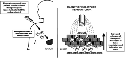 Figure 5. Schematic representation of the possible role of MNPs in enhancing monocyte-based gene delivery to tumors. MNP-loaded monocytes injected into the bloodstream of the patient circulate and are then drawn out of the blood vessels in the tumor under the inﬂuence of a local magnetic ﬁeld (CitationDavaran et al. 2014).