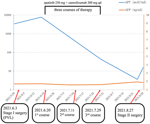 Figure 6 Dynamic changes in tumor marker levels during treatment process. The decrease of des-γ-carboxy prothrombin level reflects the reduction of tumor load. Alpha-fetoprotein was fair.