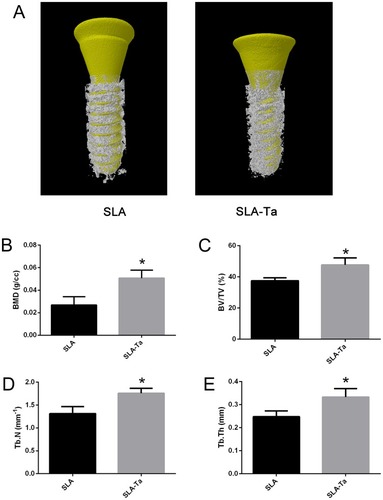 Figure 7 Micro-CT evaluation of bone tissue around dental implants at 4 weeks after implantation. (A) The reconstructed images of the implants and the surrounding bone in two groups; the BMD (B), BV/TV (C), Tb.N (D) and Tb.Th (E) of the bone adjacent to the implant surface were quantified, *P<0.5, significantly different from the control SLA group.