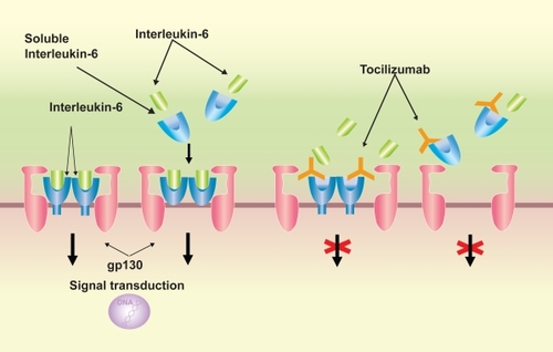 Figure 2 Signal transduction of interleukin (IL)-6 /IL-6 receptor (R) complex via gp130 and the mechanism of signal transduction blockage by tocilizumab. IL-6 signal is mediated via IL-6R on the cell surface or soluble form of IL-6R, followed by dimerization of the signal transducer gp-130, which is bound to the IL-6/IL-6R complex. Tocilizumab inhibits the binding of IL-6 to IL-6R or sIL-6R.