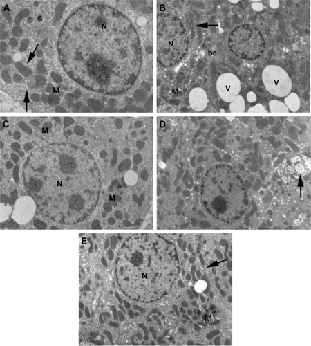 Figure 5 Electron micrographs of liver sections of rats. (A) Control shows hepatocyte with normal cellular organelles and intact nuclear chromatin; N indicates nucleus, M indicates mitochondria, and arrows indicate endoplasmic reticulum. (B) Arsenic observe increased peripheral chromatin in the nucleus (N), mitochondria (M) with ill-defined cristae, few endoplasmic reticulum (arrow) and numerous obvious vacuoles all over the cytoplasm (V); bc indicates bile canaliculus. (C) Arsenic + NAC: note that less condensed chromatin in the nucleus (N), scattered mitochondria (M), and in-between short strands of endoplasmic reticulum are visible. (D) Arsenic + DMSA: the cytoplasm is heavily populated with mitochondria and less fragmented endoplasmic reticulum (compared to B). Notable increase in organelle degeneration is still evident (arrow). (E) Arsenic + NAC + DMSA: hepatocyte is preserved without vacuolization, nucleus (N) without abnormal chromatin, normal mitochondria (M) with intact cristae, normally shaped rough endoplasmic reticulum (arrow). Original magnification 7,500× (A) and 5,000× (B–E).