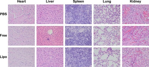 Figure 12 H–E staining of major organs after treatment.Note: Magnification ×100.Abbreviations: H–E, hematoxylin and eosin; Lipo, liposomes; PBS, phosphate-buffered saline.