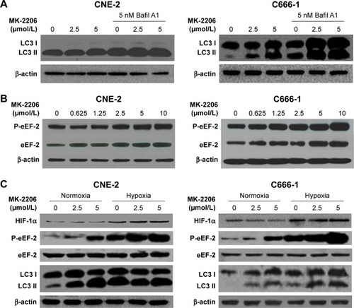 Figure 1 Effects of MK-2206 on autophagy in human NPC cell lines.