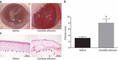 Figure 1. A successful mouse model of fungal keratitis is established. (a), Comparison of corneal state after the 7th day of Candida albicans infection in mice; (b), Clinical scoring in the Candida albicans group and the saline group; (c), The HE staining of the corneal tissue in mice at the 7th day after modeling with black arrows indicating corneal stromal fibers and red arrows indicating inflammatory cells (× 400), *, p < 0.05; HE, hematoxylin-eosin; n = 12 in the saline group and n = 10 in the Candida albicans group; all data were measurement data, expressed as mean ± standard deviation and analyzed by t-test; the experiment was repeated three times.