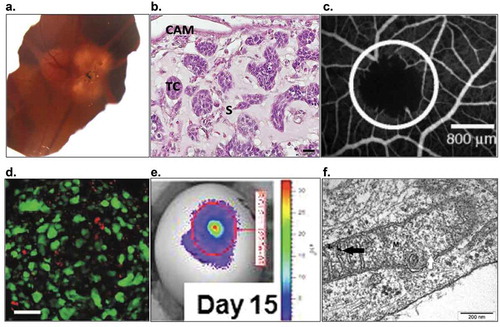 Figure 4. Various imaging technologies are compatibly employed to monitor and analyze the tumor and vascular networks. (a) Suit2.28 wt pancreatic carcinoma imaged 7 days after grafting using stereomicroscope (unpublished data). (b) Harvested tumor of UPCI:SCC-154 head and neck squamous cell carcinoma stained with H&E (TC = tumor cells; S = stroma; scale bar = 20 μm; unpublished data) (c) Vascular occlusion following PDT imaged through fluorescence angiography. Reproduced with permission from from Vargas et al. [Citation171]. Copyright 2007 by Elsevier B.V. (d) Fluorescence immunohistochemistry of prostate tumor section, demonstrating the accumulation and penetration of viral nanoparticles (green = GFP-expressing PC-3 cells; red = viral NPs; scale bar = 75 μm). Reproduced with permission from Steinmetz et al. [Citation137]. Copyright 2011 by WILEY-VCH Verlag GmbH & Co. KGaA, Weinheim. (e) Bioluminescence intensity of Fluc-mCherry PDAC tumors at 15 days after grafting. Adapted from Rovithi et al. [Citation11]. Copyright 2017 by the authors (f) TEM image depicting a mitochondrion (m) of glioma tumor incubated with platinum nanoparticles (black arrows; scale bar = 200 nm). Reproduced from Kutwin et al. [Citation149]. Copyright 2016 by Termedia & Banach