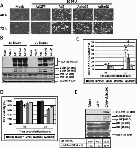 Figure 3. The effect of E1b-19K upon JNK phosphorylation. A549 cells were mock treated or infected with AdGFP, Ad5, Adhz63 and Adhz60 at 10 PFU/cell. (a) CPE induction in mock, AdGFP, Ad5, Adhz63 and Adhz60 treated cells. Pictures were taken using an inverted microscope at 200x total magnification at 48 and 72 h post-infection. 600 µm scale bar is located in the top right corner. (b) A549 cell lysates were observed for the production of the indicated proteins via Western blot analysis. (c) These Western blot data were quantified via densitometric analysis using Gel-pro analyzer 4.0 software and these IOD values were normalized to actin. These values were then converted to fold changes by dividing the values by the values for mock treated cells; mock = 1-fold. One of three representative experiments is shown. (d) Cell viability was determined by crystal violet staining and expressed as the percent cell viability relative to non-treated cells. One of three representative experiments is shown. (e) A549 cells were mock transfected, or were transfected with GFP or CMV-E1b19K plasmids as indicated. These cells were then lysed and observed for the production of the indicated proteins. * indicates p-value < 0.05, † indicates p-values < 0.01.