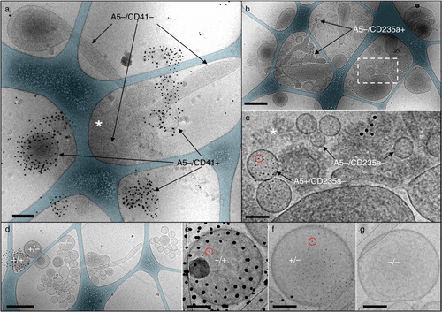 Fig. 2.  Representative cryo-electron microscopy images of EV aggregates in 100k-PFP samples. (a, d–g), double labelling with 10 nm anti-CD41-gold-NPs and 4 nm Anx5-gold-NPs; (b, c), double labelling with 10 nm anti-CD235a-gold-NPs and 4 nm Anx5-gold-NPs. In (a), several A5−/CD41+ EVs and A5−/CD41− EVs are indicated, associated with some amorphous material (white asterisk). (b), Aggregate associating several 10s of EVs, including several A5−/CD235a+ EVs. (c), High magnification view of the dashed box from (b), allowing one to distinguish between A5+/CD235a− EVs and A5−/CD235a− EVs. One Anx5-gold-NP is circled in red. The white asterisk points to amorphous material. (e–g), High magnification views of the EVs from (d) labelled +/+ (for A5+/CD41+), +/− (for A5+/CD41−) and −/− (for A5−/CD41−), respectively. One Anx5-gold-NP is circled in red in (e) and (f). For the sake of clarity, the carbon net has been overlaid in turquoise in (a, b, d). Scale bars: a, b, d: 500 nm; c, e–g: 100 nm.