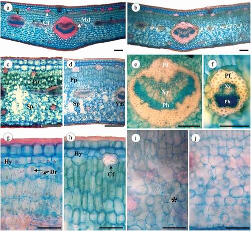 Figure 5. Jacquinia armillaris leaves in cross-section. (a, c, g, i): of TO samples. (b, d, e, f, h, j): of TU samples. (a,b): Leaf section of the primary vein. (c,d): Leaf detail showing palisade and spongy parenchyma. (e,f): primary vein and vascular bundle, xylem and phloem recovery with fibers. (g,h): adaxial region showing the hypodermis and palisade parenchyma cells. (i,-j): Leaf abaxial region, note the spongy parenchyma cells and intercellular spaces (*). Abbreviations: Cf: cortical fibers; Md: midrib; Pp: palisade parenchyma; Sp: spongy parenchyma; VB: vascular bundle; Xy: xylem; Ph: Phloem; Pf: perivascular fibers; Hy: hypodermis; Dr: druses. Scale bars: 100 μm