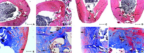 Figure 2. Defect healing in ovariectomized rats after the eight-week healing period in SR group (A) and (E), SC group (B) and (F), CC group (C) and (G) and AC group (D) and (H). Connective tissue (CT), boundary between old and new bone (Bd), mature bone (MB), immature bone incurred in remodelling (IB), implanted Bio-Oss (★), remodelation site (RS). Up – H&E, 200 μm scale bar; Down – Masson's trichrome, 50 μm scale bar.