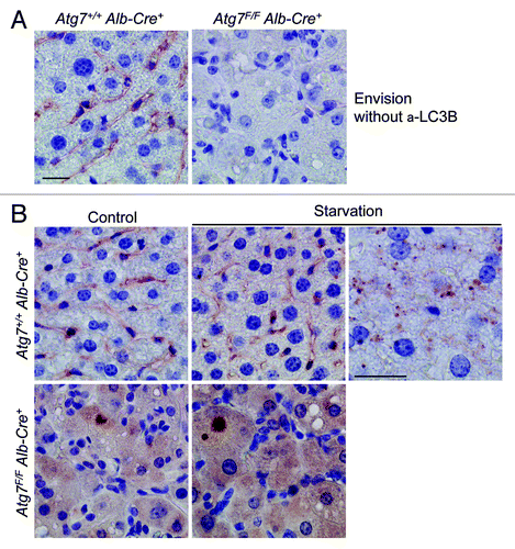Figure 11. Livers from starved wild-type mice show background staining with anti-mouse Envision+. (A) Anti-mouse Envision+ without primary antibody results in background staining of Atg7+/+ Alb-Cre+ liver, but not of Atg7F/F Alb-Cre+ liver. (B) Liver samples were isolated from fed Atg7+/+ Alb-Cre+ and Atg7F/F Alb-Cre+ mice (control) or from mice that underwent starvation for 48 h. After fixation in neutral buffered formalin for 24 h, tissues were paraffin-embedded and stained for LC3B using unconjugated mouse monoclonal anti-LC3B (clone 5F10, Nanotools, 1:100), in combination with Envision+. Heat-mediated antigen retrieval was performed in citrate buffer (pH 6.0). Scale bar, 20 μm. One panel of starved Atg7+/+ Alb-Cre+ hepatocytes (around blood vessel) was taken at higher magnification and illustrates tiny LC3B positive puncta.