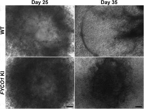 Figure 4. FYCO1 (c.2206C>T) knock-in (KI) human embryonic stem cell (hESC)-derived lentoid bodies revealed opaque central zones. Phase-contrast microscopy was performed on differentiation days 25 and 35 during lentoid body formation. On differentiation day 25, FYCO1 KI hESC-derived lentoid bodies show reduced transparency in the central zones compared with wild type (WT) hESC-derived lentoid bodies. The effect of the KI allele becomes more evident on day 35 with opaque zones present in the FYCO1 KI hESC-derived lentoid bodies, in sharp contrast to the WT hESC-derived lentoid bodies that displayed extensive transparent zones. Note: Image magnification: 5x; Scale bars: 100 μm.