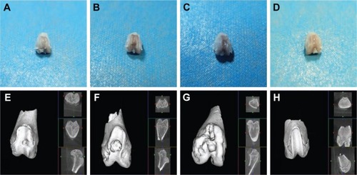 Figure 5 General observation and micro CT observation of the knee joints.Notes: (A–D) General observation. (E–H) Micro CT observation. (A and E) The bioactive resveratrol–PLA–gelatin porous nano-scaffold group. (B and F) The blank porous PLA–gelatin nano-scaffold group. (C and G) The no scaffold group. (D and H) The sham group.Abbreviation: CT, computed tomography.