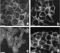 3 Immunostaining of E-cadherin (a, b) and β-catenin (c, d) in HepG2 cells after 12 days of culture in the absence (a, c) or presence (b, d) of RA. After long-term RA treatment E-cadherin and β-catenin are both localized on the cell membrane and the scattered cytoplasmic staining of controls disappears. Note the lack of β-catenin nuclear immunoreactivity in the treated cells (d). There was no labeling when the first antibody was omitted (not shown). Bars =10 μm. (See Color Plate III).