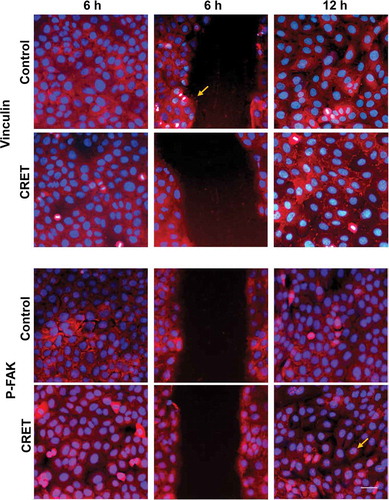 Figure 4. Immunofluorescence expression of Vinculin and p-FAK in keratinocytes. Monolayers (side columns) at 6 and 12 hours of CRET or sham treatment (Control), and in wound edges (central column) at 6 hours only. Representative merged micrographs. Red: vinculin or p-FAK labeling. Blue: nuclei. Bar: 20 µm. Brightness and contrast adjustments were applied to the whole of each image using Photoshop software. The adjustments in the micrographs of the treated samples were the same as those in the images of their controls. The arrows highlight presence of vinculin labeling on the membrane of 6-hour control cells located at the migration front, and that of p-FAK in the nuclei of 12-hour exposed cells