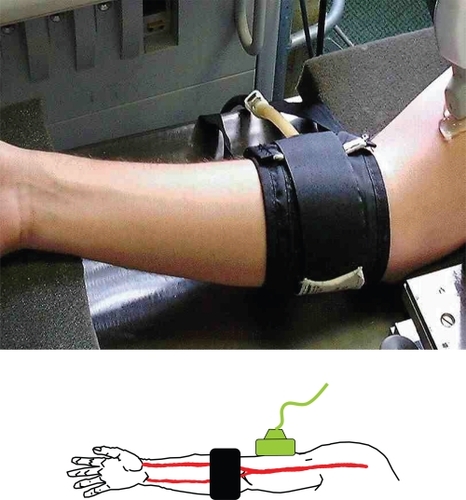 Figure 1 Probe position in relation to cuff.