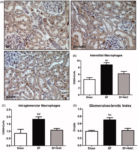 Figure 6. N-acetylcysteine (NAC) ameliorates renal inflammation. (A) Immunostaining (brown) for CD68 + cells in kidney cortex samples (Magnification, ×400). (B) Number of CD68 + positive cells per field (0.087 mm2) located in the interstitial space. (C) Number of CD68 + positive cells per glomeruli. (D) glomerulosclerotic index. SF: Star fruit group, SF + NAC: star fruit + NAC therapy, Sham: control group. Data are mean ± SEM; ap < .001, bp < .01 vs. Sham; cp < .01, dp < .05 vs. SF + NAC.