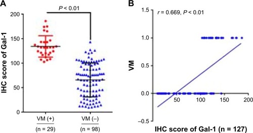 Figure 3 Correlation between Gal-1 expression and VM and clinicopathological features. (A) The Gal-1 IHC scores in primary tumors with VM were significantly different from Gal-1 scores in primary tumors without VM (P < 0.01). (B) Spearman correlation analysis showed significant correlation between Gal-1 expression and VM (r = 0.669, P < 0.001). The Y-axis values indicate VM status: 0, VM-negative; 1, VM-positive.